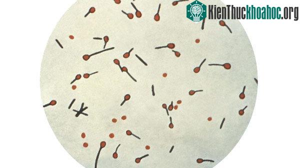 Uốn ván là căn bệnh gây ra bởi vi khuẩn có tên Clotridium tetani (C.tetani)