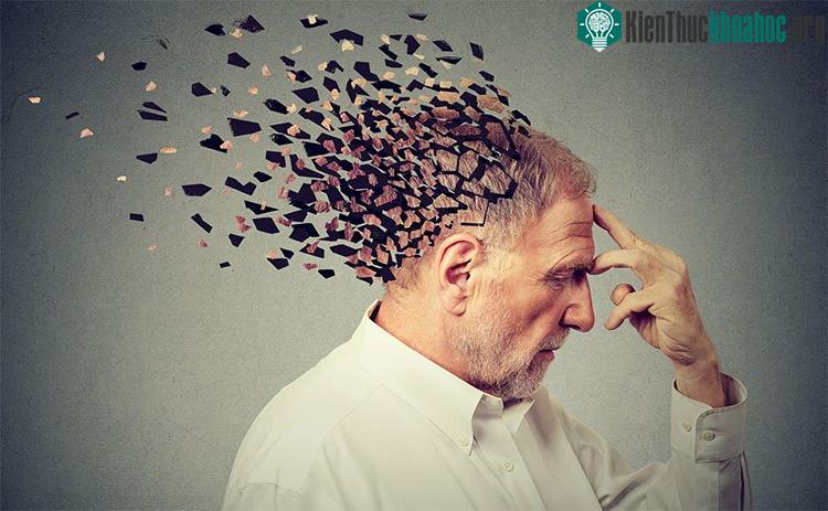Khi già đi, bộ não thay đổi rất nhiều.