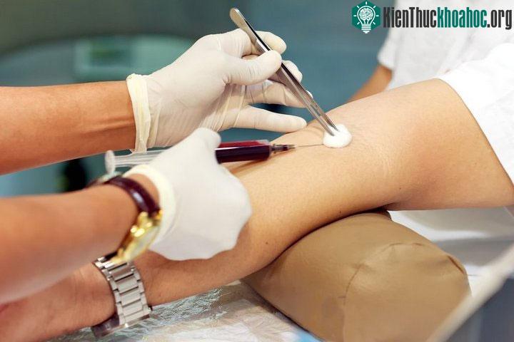 Các bác sĩ, y tá hầu hết đã có kinh nghiệm trong việc xác định đúng vị trí tĩnh mạch.