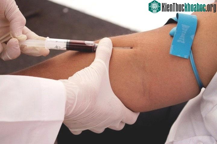 Thông thường các bác sĩ sẽ chọn tĩnh mạch nằm gần lằn khuỷu tay để tiêm.