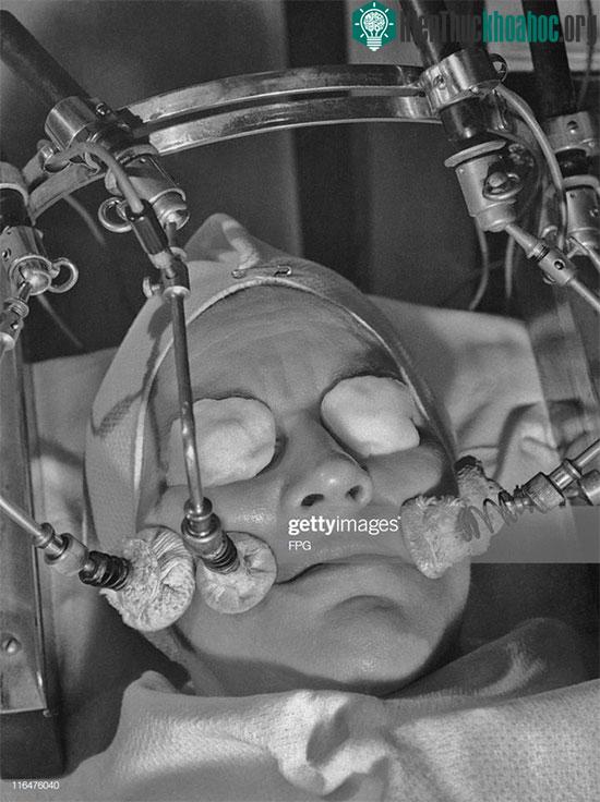 Chiếc máy mát xa mặt vào những năm 1950.