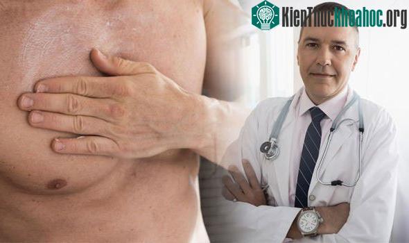 Đàn ông không nên chủ quan khi phát hiện dấu hiệu lạ trên ngực.