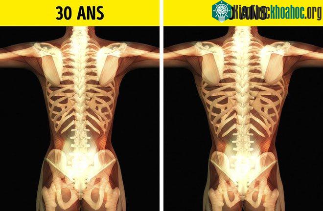 Khi bước vào tuổi lão hóa, bộ xương của chúng ta sẽ lớn hơn và mỏng đi khoảng 10%.