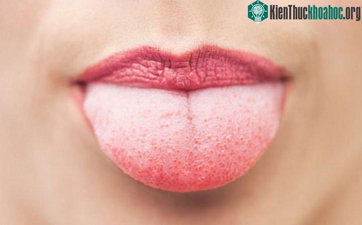 Sự thay đổi cấu trúc trong nụ vị giác dẫn tới suy giảm vị giác.