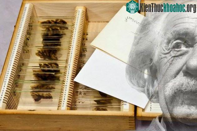 Chiếc hộp đựng các lát não của thiên tài khoa học.