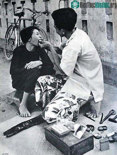 Dịch vụ cà trắng răng ngay trên vỉa hè.