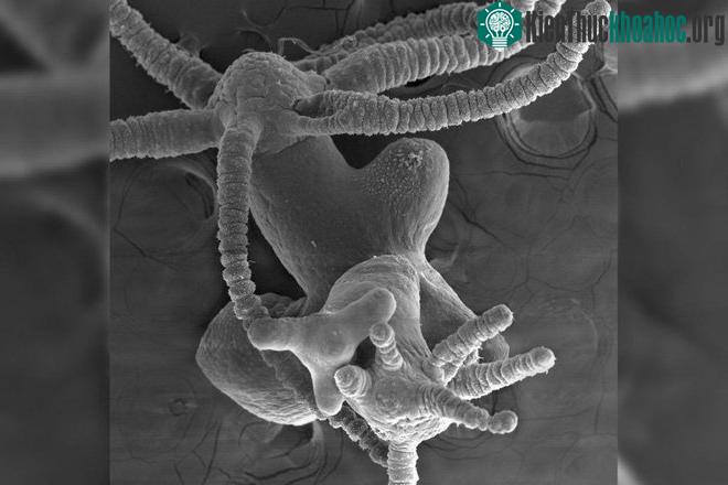 Những "chiếc đầu" mọc ra từ cơ thể Hydra.