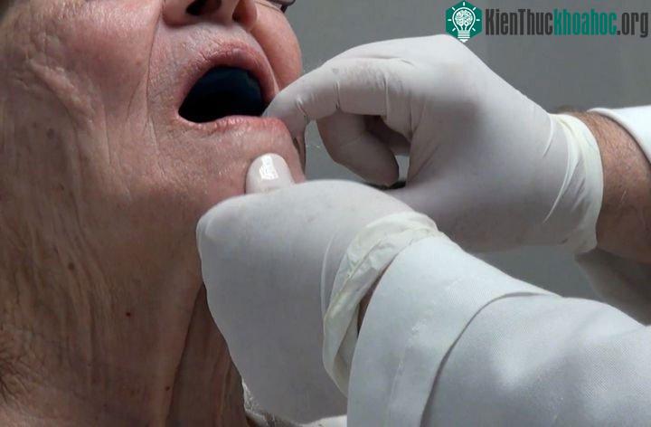 Nhai kém cũng là một yếu tố góp phần dẫn tới giảm khả năng cảm nhận hương vị.
