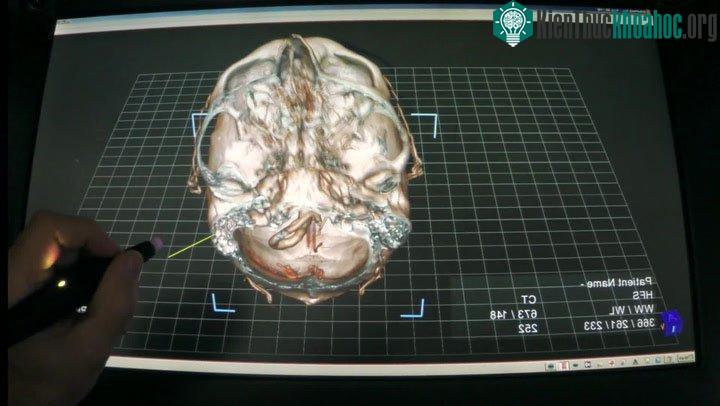 Các nhà phát triển phần mềm đang làm việc thêm với các bác sĩ để nâng cấp ứng dụng.