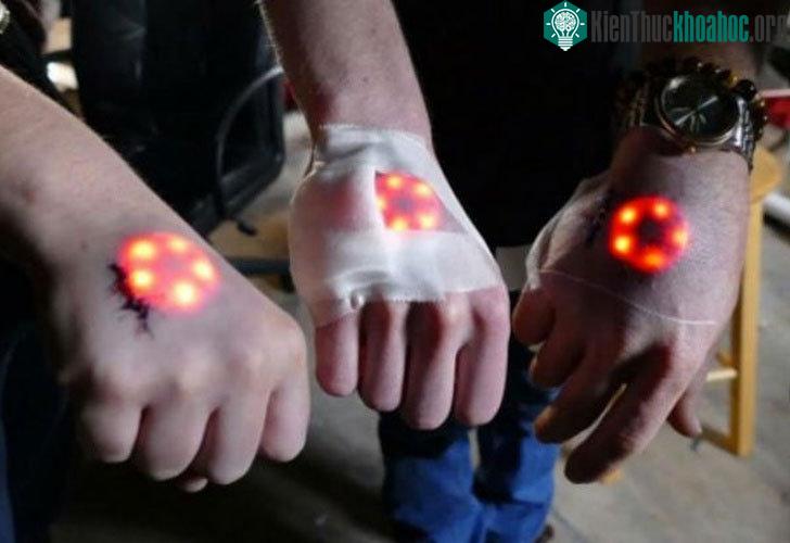 Nhiều người cấy chip vào tay.