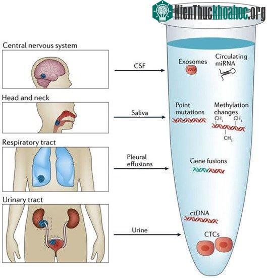 Nhiều loại ung thư có thể được phát hiện sớm nhờ sinh thiết lỏng.