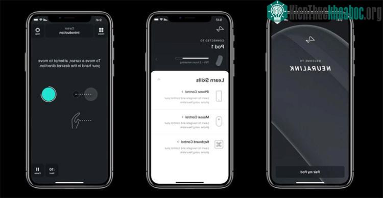 Elon Musk đầu tư trăm triệu USD để "khâu" chip vào não người ảnh 4