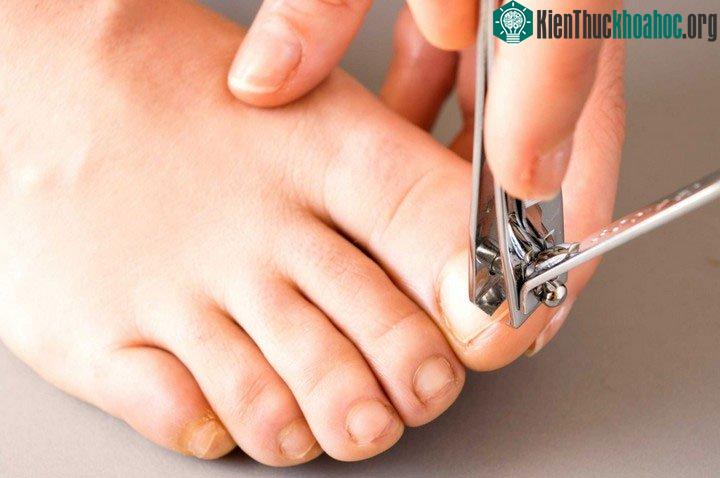 Cách làm đúng khi cắt móng chân, móng tay, đó là làm sao để tránh các vấn đề về chân.