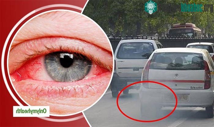 Tiếp xúc với khói xe trong thời gian dài làm tăng nguy cơ thoái hóa điểm vàng.