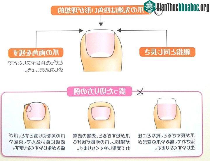Chuyên gia Nhật khẳng định mọi người đều cắt móng chân sai cách, đây mới là cách làm đúng! ảnh 1