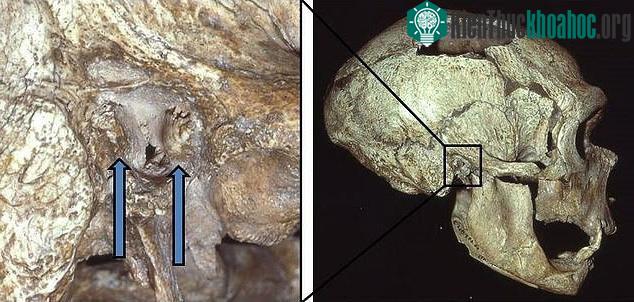 Một hộp họ thuộc hài cốt người Neanderthals, chứa đặc điểm lạ