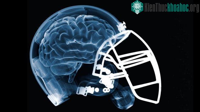 CTE vẫn là một căn bệnh bí ẩn