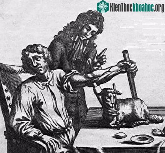 Jean-Baptiste Denis tiến hành truyền máu cừu cho bệnh nhân