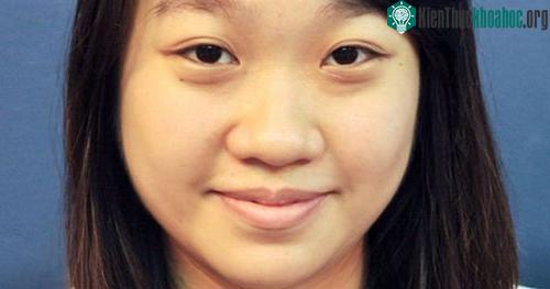 Mũi người Đông Á thấp để thích nghi với khí hậu.