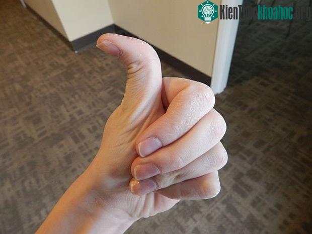 Đặc điểm hiếm có trên cơ thể người ảnh 1