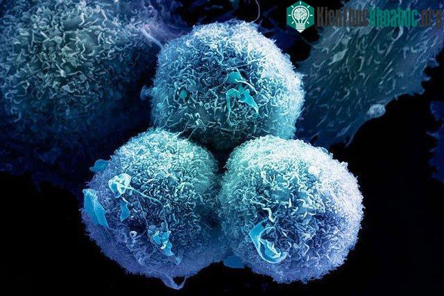 Một loại thuốc nhắm đích mới có thể thu nhỏ 67% khối u ung thư trên người ảnh 1
