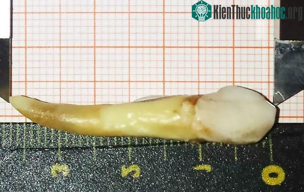 Chiếc răng mới được nhổ này là chiếc răng dài nhất từ ​​trước đến nay