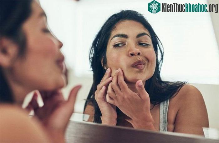 Mụn có liên quan đến sự thay đổi về tuổi của microbiome (hệ vi sinh vật).