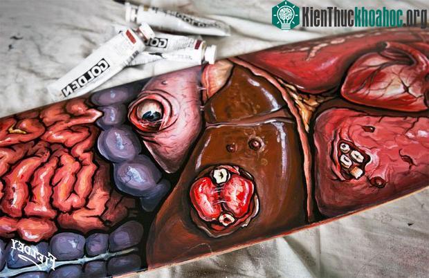 Mô phỏng về u quái - có thể mọc ở bất kỳ bộ phận nào.