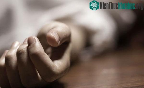 Da của người sắp chết thường sẽ tái đi và có các màu tía, đỏ hoặc vết lốm đốm xanh.