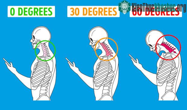 Góc cúi khi sử dụng điện thoại di động có thể gây ra nhiều phiền toái.