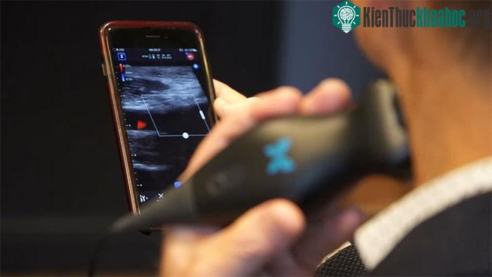 Thiết bị siêu âm cầm tay này đã được hàng nghìn bác sĩ ở Mỹ chọn sử dụng