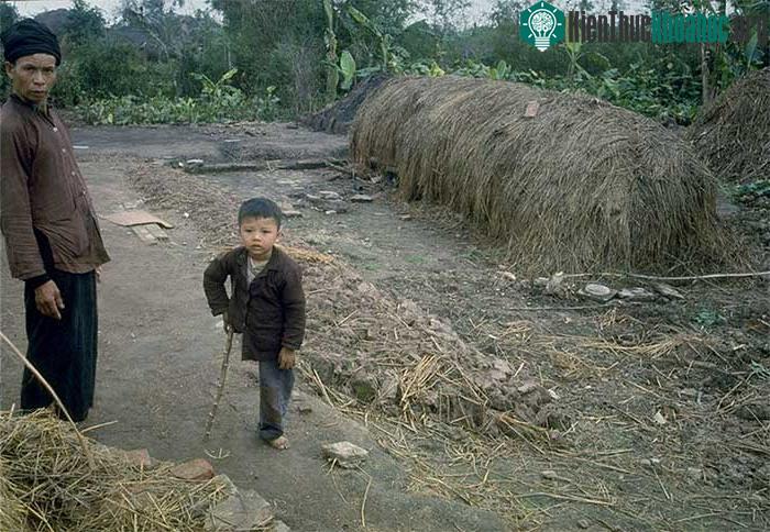 Một em bé ở khu vực ngoại ô bị mất chân do bom Mỹ đứng cùng bố trên đường làng.