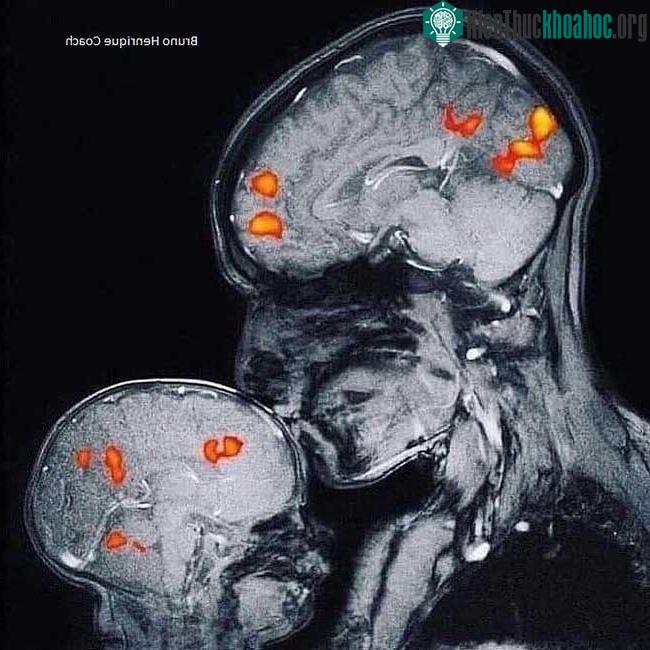 &nbsp;Hình ảnh MRI này được chụp khi nhà thần kinh học Rebecca Sax bế và hôn đứa con trai 2 tháng tuổi