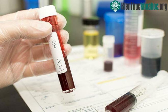 Các bệnh truyền nhiễm, trong đó có HIV được ước tính gây ra 4 triệu cái chết trong năm 2020.