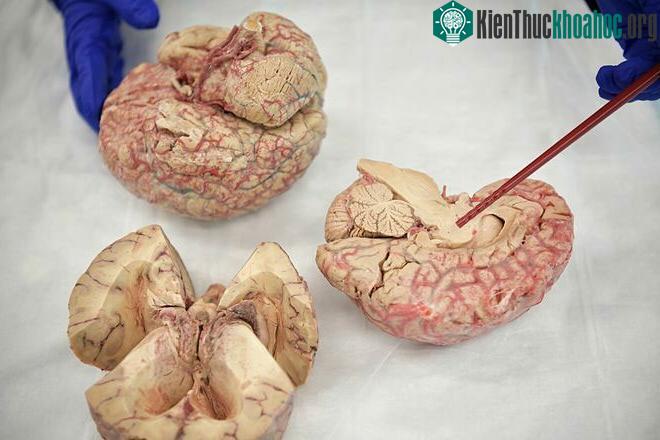 Ngân hàng não cho phép các nhà khoa học phân tích mô não người châu Á.