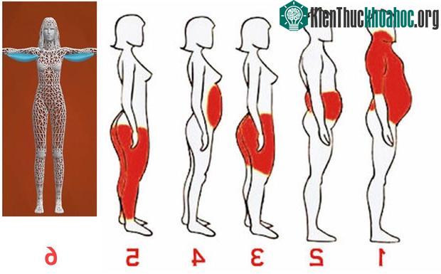 Béo phì từng bộ phận trên cơ thể người.