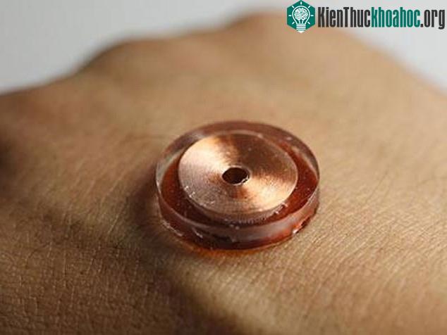 Một thiết bị trợ rung tí hon