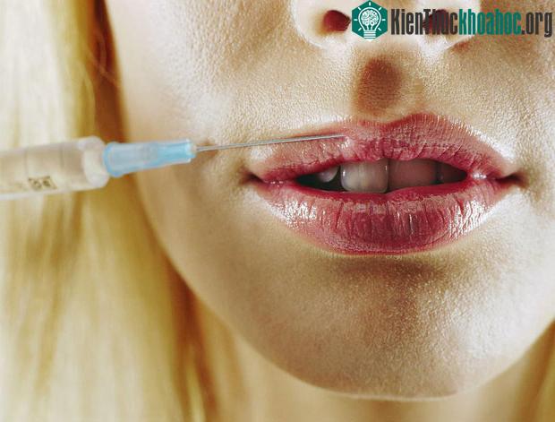 Nhiều bộ phận của bò - như gân, xương... có chứa collagen.