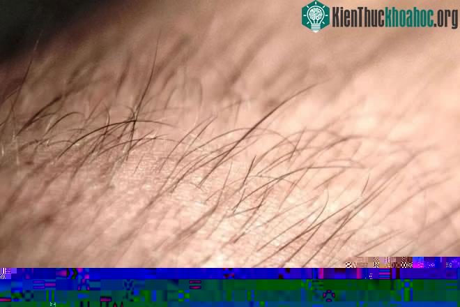 Tốc độ tăng trưởng của tóc người bình thường là khoảng 1cm mỗi tháng.
