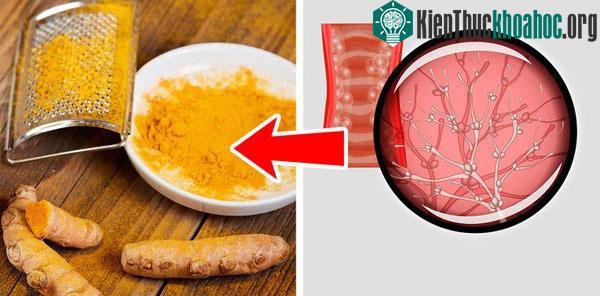 Nghệ ngừa nhiễm nấm "vùng kín"