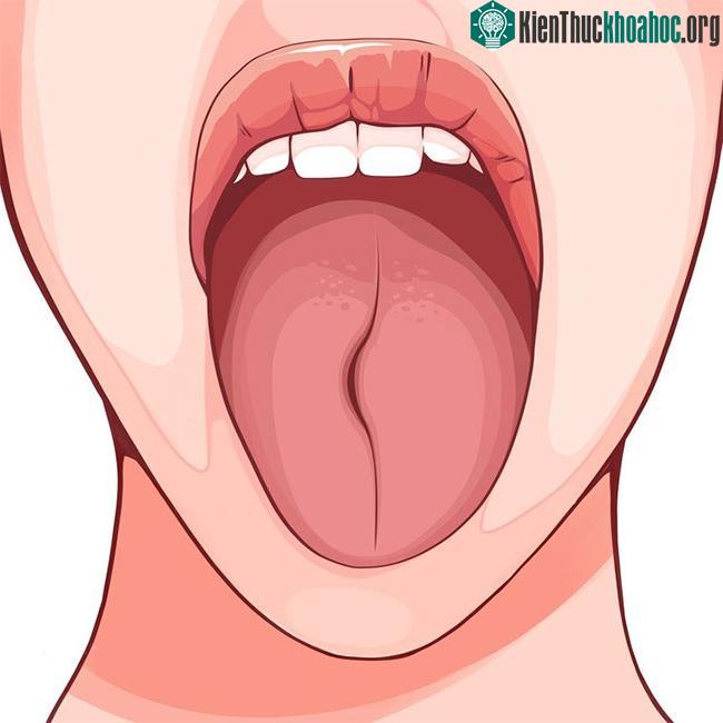 Một khúc cong ở giữa nếp gấp dọc có thể chỉ ra các vấn đề ở vùng ngực.