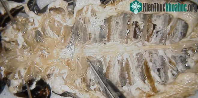Dây thần kinh và hạch ở giữa những thứ "bầy nhầy" màu trắng