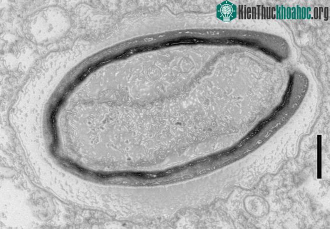 Pandoravirus