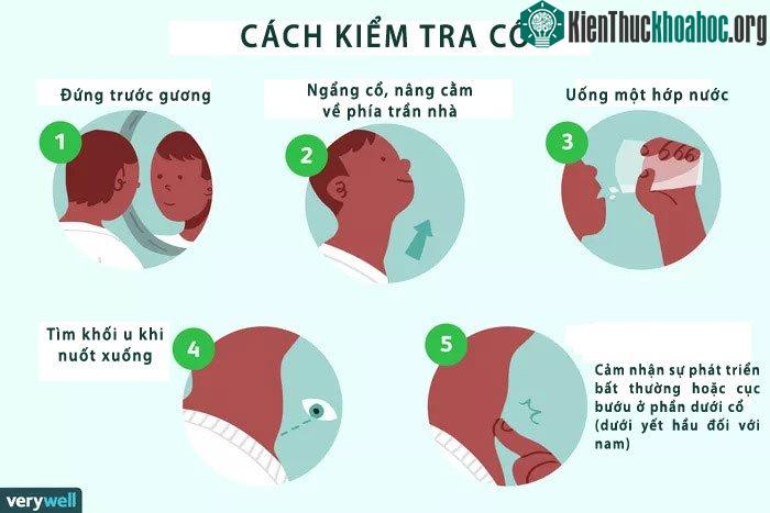 Các bước kiểm tra cổ tại nhà.