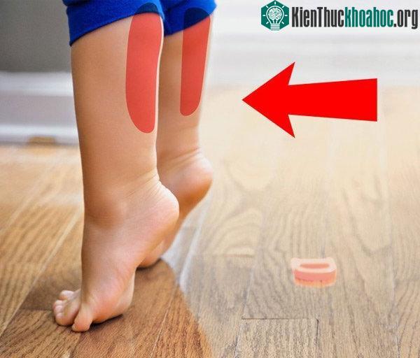Vì sao trẻ thường đi bằng mũi chân? ảnh 1