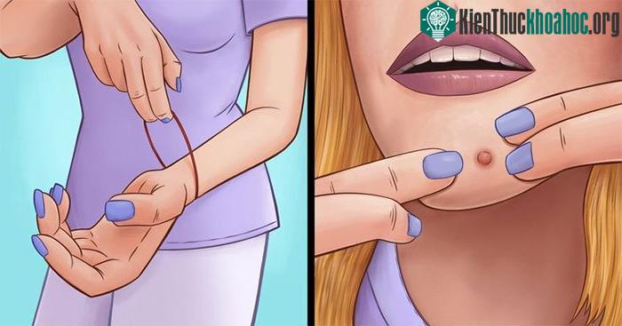 Nặn mụn có thể làm cho các nốt mụn trở nên tồi tệ hơn.