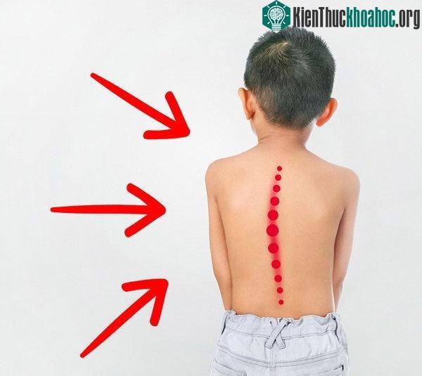 Vì sao trẻ thường đi bằng mũi chân? ảnh 2