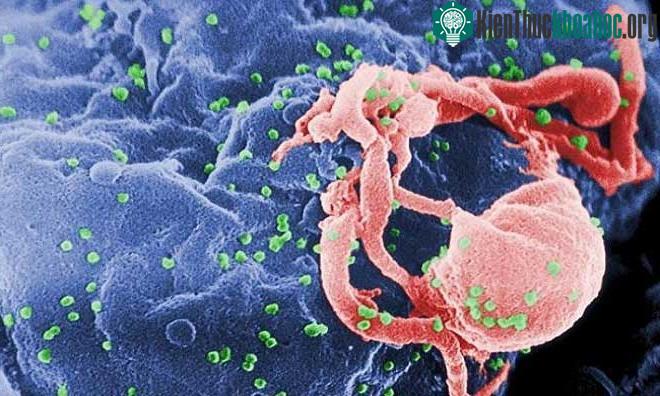 Virus HIV