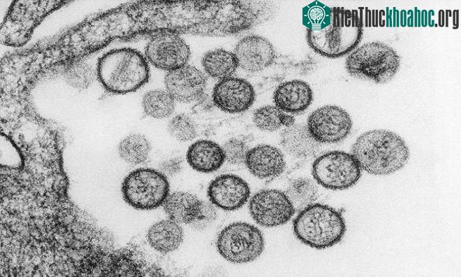 Virus Hanta