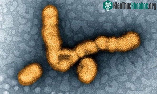 Virus cúm mùa